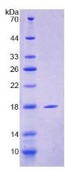 SDS-PAGE (Cd209a-7174M).jpg